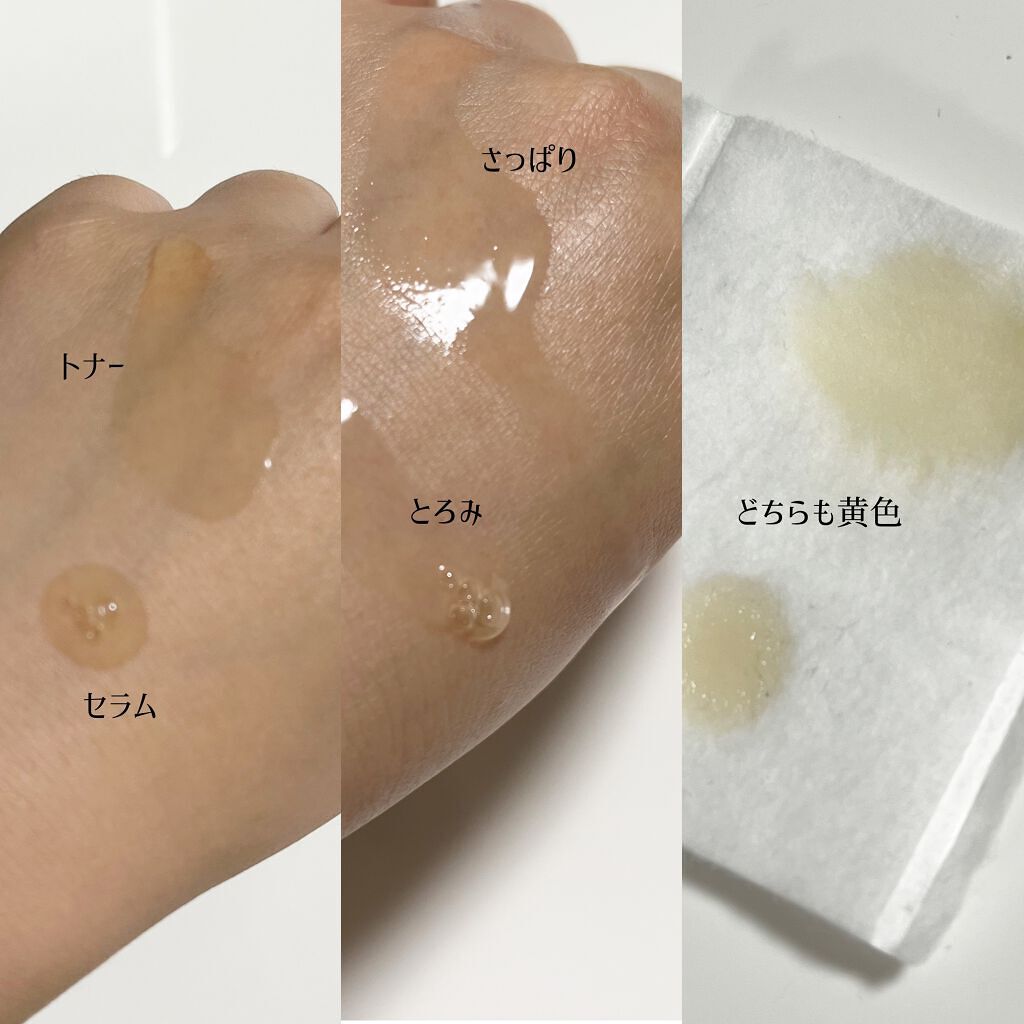 ガラクトミセスピュアビタミンCグロートナー/SOME BY MI/化粧水を使ったクチコミ（2枚目）