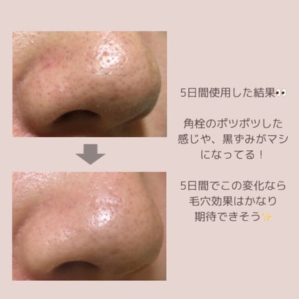 マイルドクレンジング オイル/ファンケル/オイルクレンジングを使ったクチコミ(3枚目)