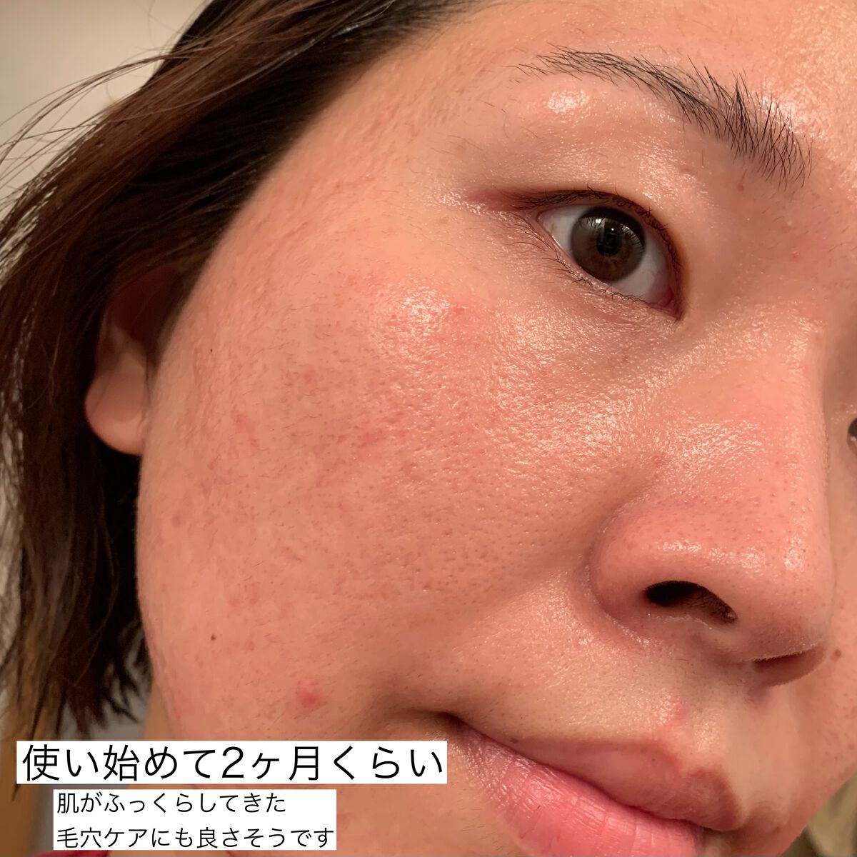 DS RTN リニューイング セラム/Kiehl's/美容液を使ったクチコミ(5枚目)