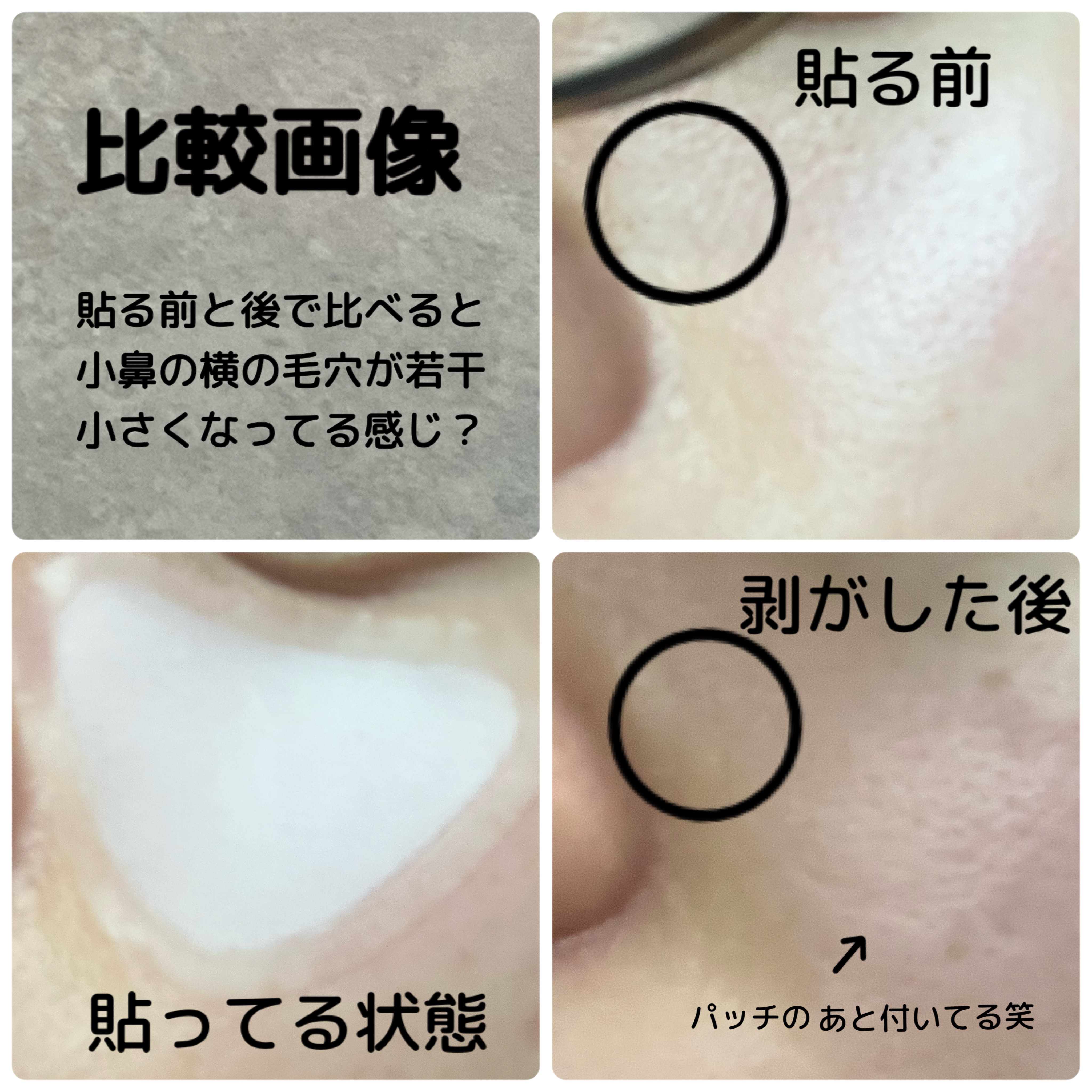 バクチオールポアジェットマイクロ800ショットパッチ4枚/Dr.G/その他スキンケアを使ったクチコミ（3枚目）