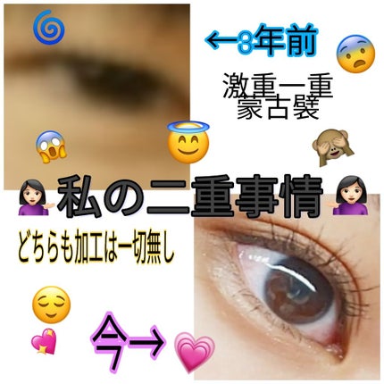 アイテープ(絆創膏タイプ、レギュラー、70枚)/DAISO/二重まぶた用アイテムを使ったクチコミ(1枚目)