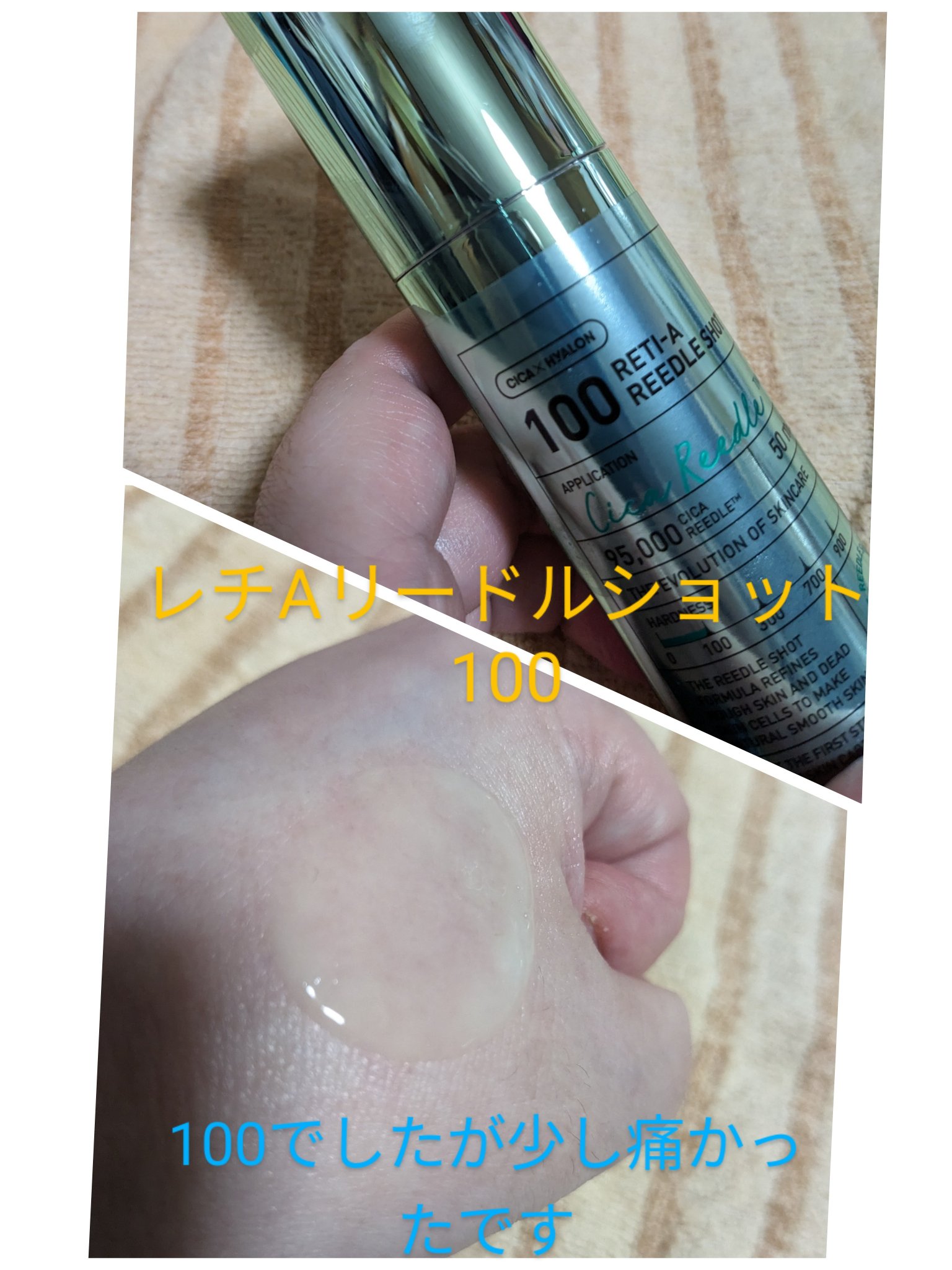 シカレチA エッセンス0.1/VT/美容液を使ったクチコミ（2枚目）