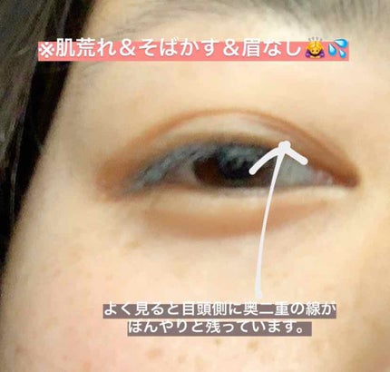 のびーるアイテープ(絆創膏タイプ、レギュラー)/DAISO/二重まぶた用アイテムを使ったクチコミ(4枚目)