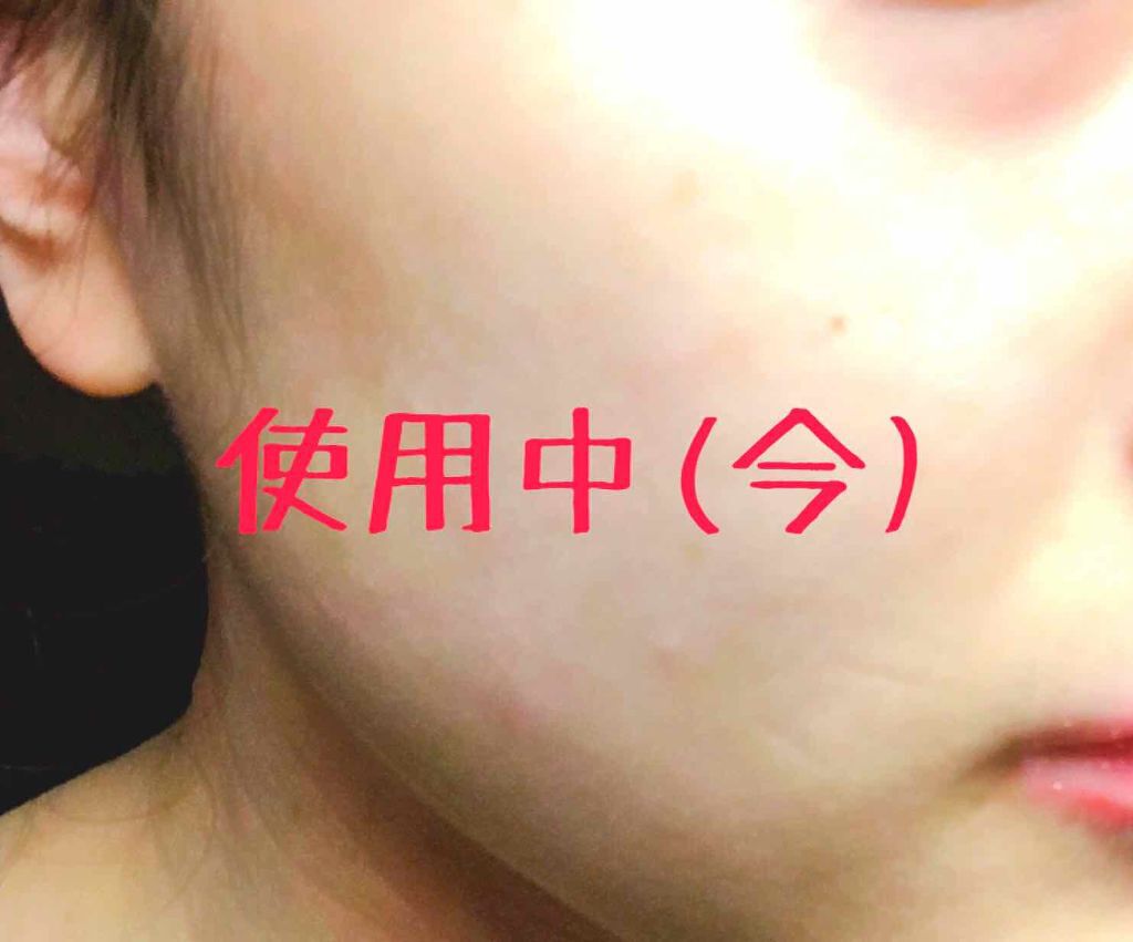 カプチュール ユース レッドネス ミニマイザー/Dior/美容液を使ったクチコミ（3枚目）