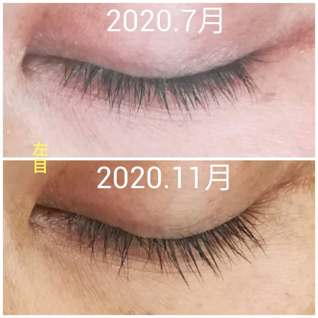 FEG  Eyelash  Enhancer/FEG/まつげ美容液を使ったクチコミ（3枚目）