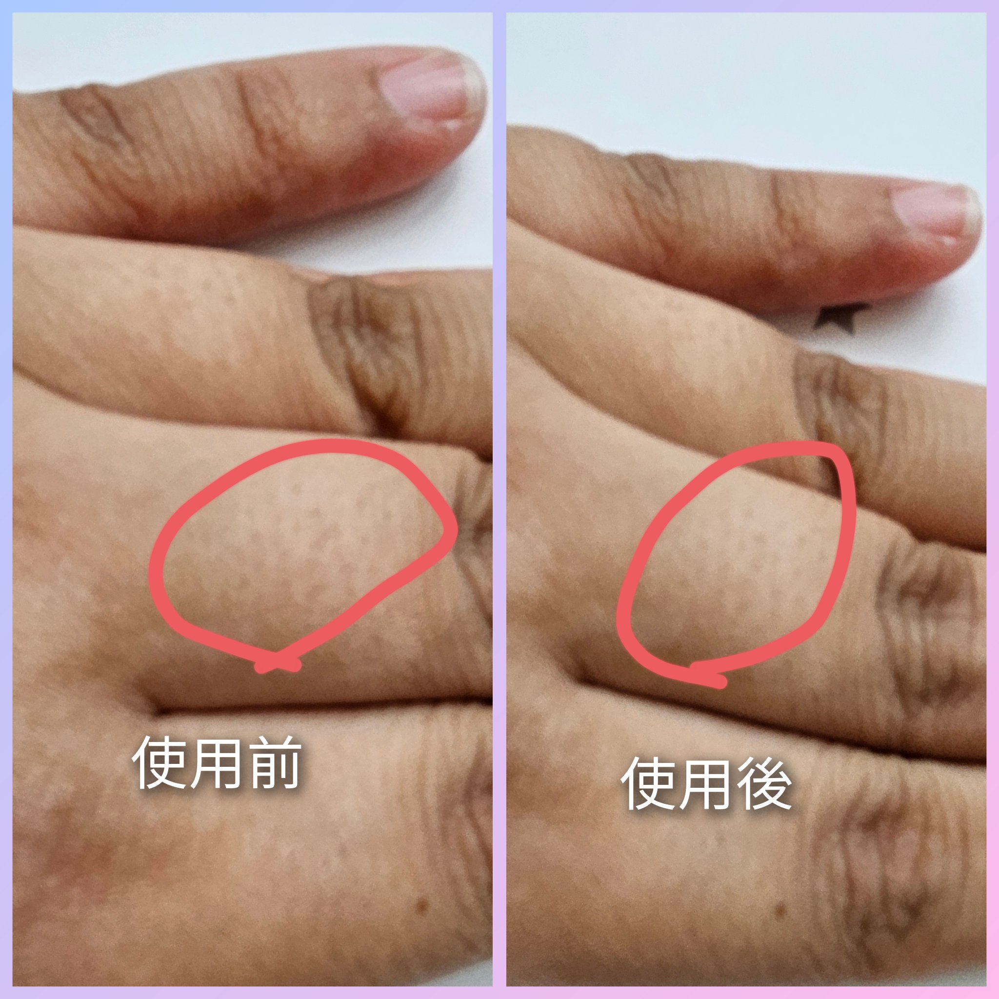 eosika SIPL-1000C 家庭用光美容器のクチコミ「 ☆ 軽くて片手に収まるサイズで楽々
☆ タッチセンサ一搭載で肌に密着している時だけ照射 
☆.....」（3枚目）