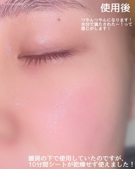 ルルルンピュア エブリーズ/ルルルン/シートマスク・パックを使ったクチコミ(5枚目)