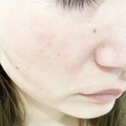 トリデン ダイブインマスクパック/Torriden/シートマスク・パックを使ったクチコミ(10枚目)