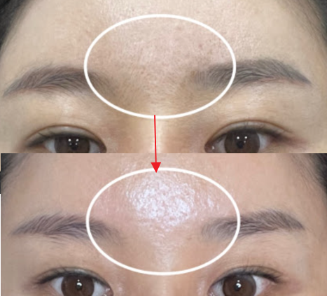 ボツルショット700/CELLINSHOT/ブースター・導入液を使ったクチコミ（3枚目）