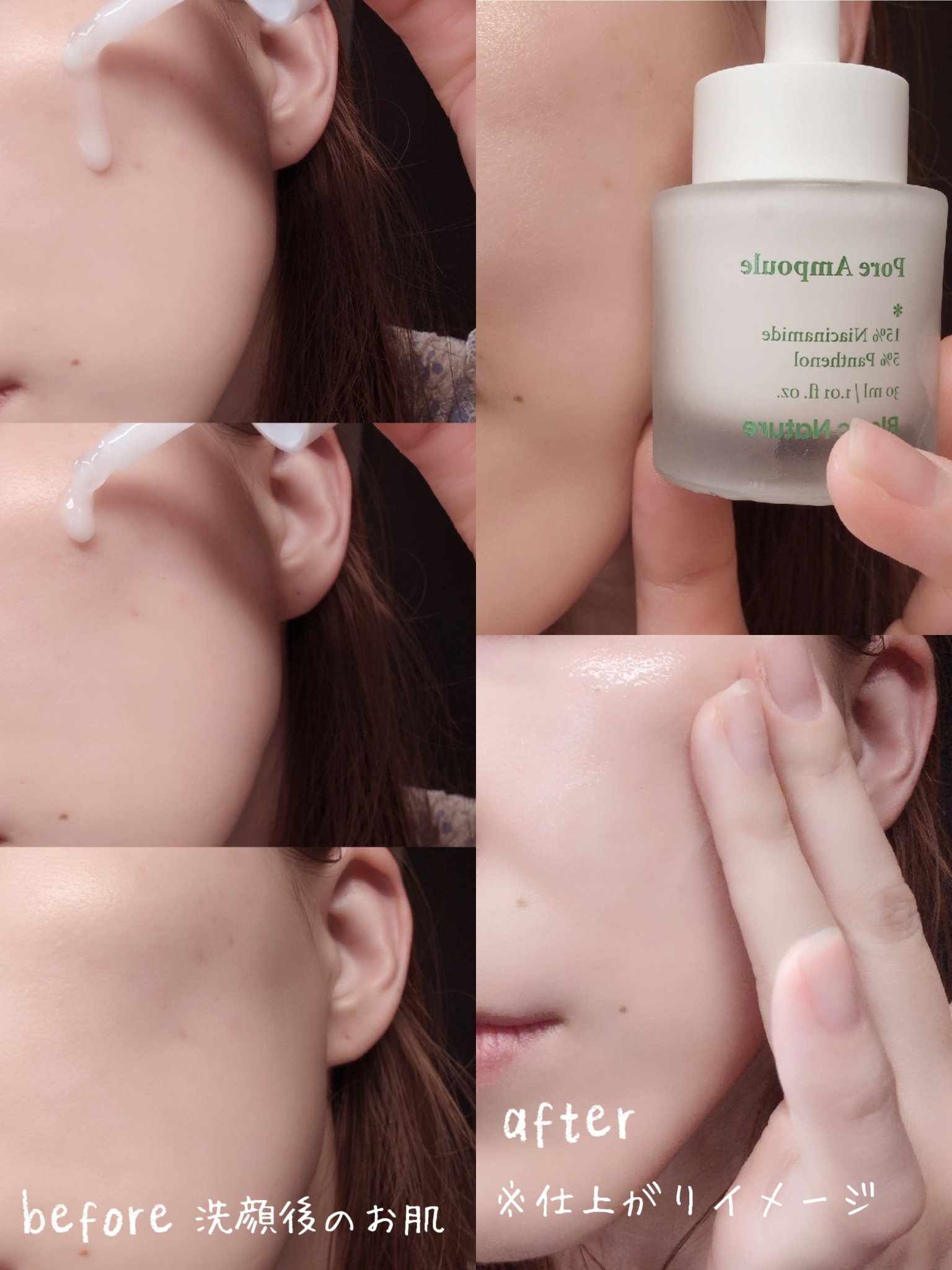 毛穴アンプル/ブラン/美容液を使ったクチコミ（2枚目）