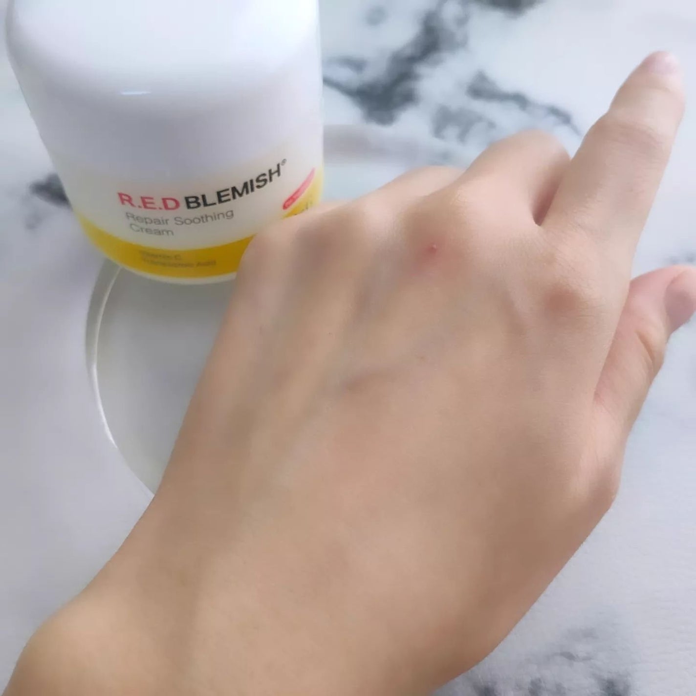 レッドブレミッシュ リペアスージングクリーム/Dr.G/フェイスクリームを使ったクチコミ(6枚目)