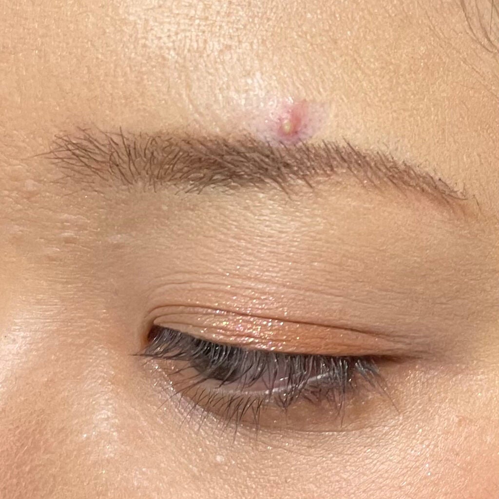 極薄透明パッチ nikipa!/金冠堂/にきびパッチを使ったクチコミ(6枚目)