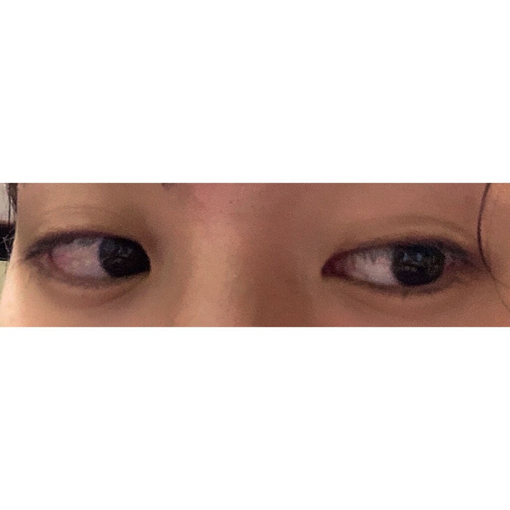 イオン 導入・導出型 美顔器 クラリティ:リンクル (L) Areti.1026/Areti./美顔器・マッサージを使ったクチコミ(3枚目)