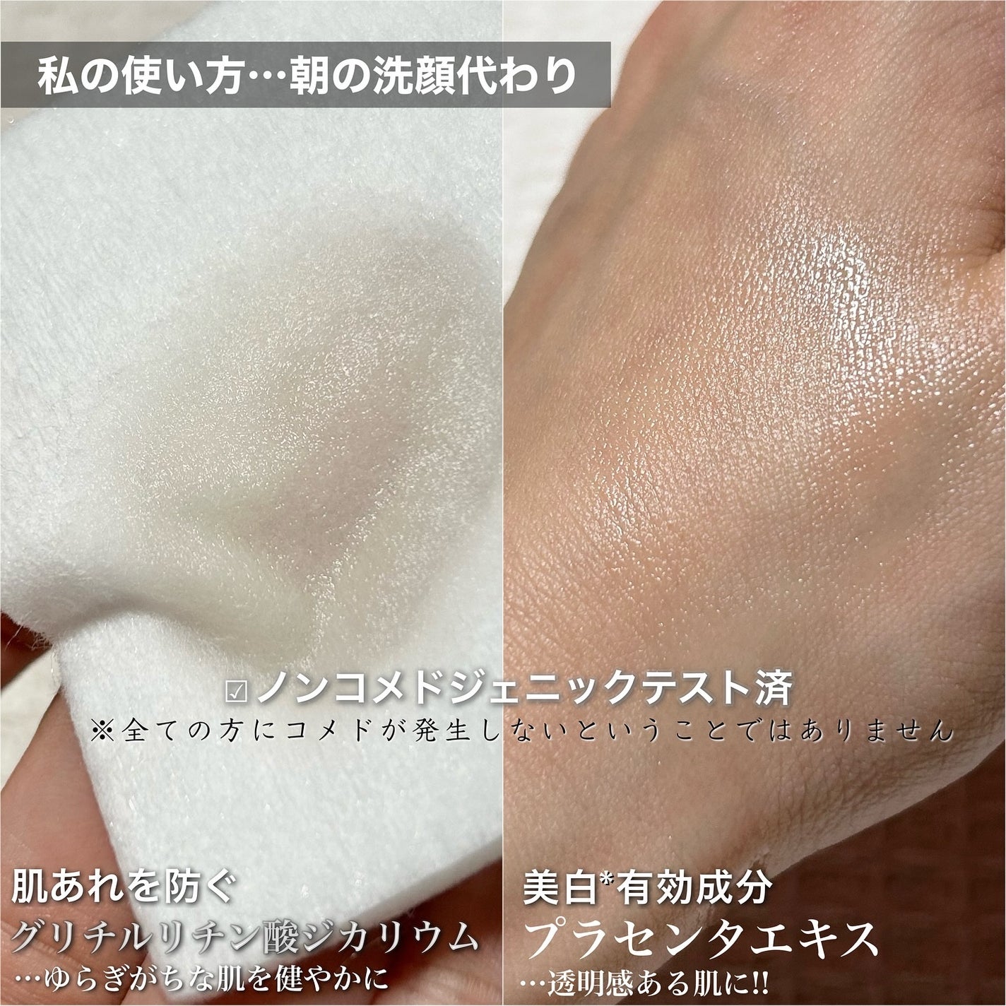 ネイチャーコンク 薬用 クリアローションとてもしっとり/ネイチャーコンク/拭き取り化粧水を使ったクチコミ(3枚目)