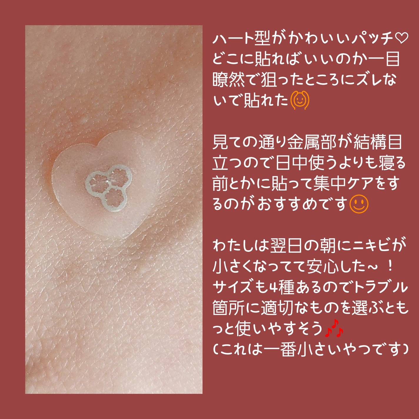 ACマグネシウムパッチ ミニ/スノーツープラス/にきびパッチを使ったクチコミ(2枚目)