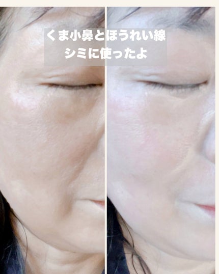 TIMAGE クリーミーコンシーラーパレット/TIMAGE/パレットコンシーラーを使ったクチコミ(7枚目)