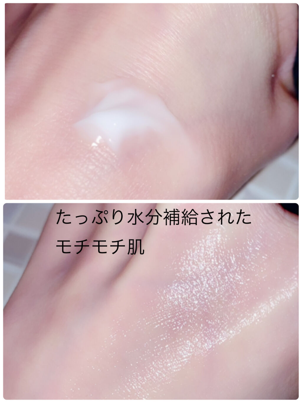 モイスチュア インストール/カルテHD/オールインワン化粧品を使ったクチコミ（2枚目）