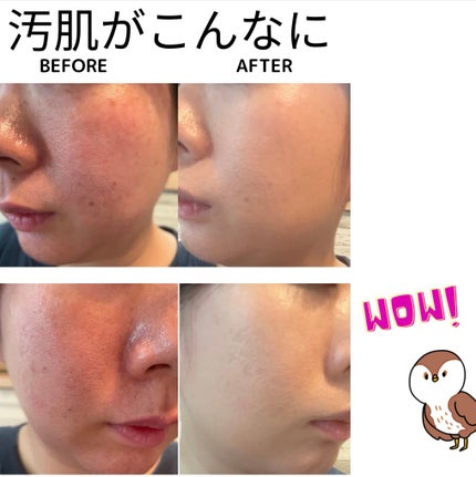 プリマヴィスタ デイトリートメントバーム 〈ローラータイプ〉/プリマヴィスタ/その他ファンデーションを使ったクチコミ(2枚目)