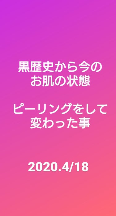 おはようございます☀
スキンケア後の今のお肌です。(2020/04/18 10:58:14)
けして、綺麗とは言えませんがだいぶマシになりました😭

①そして私がピーリング終了後も続けていた事。
前の投