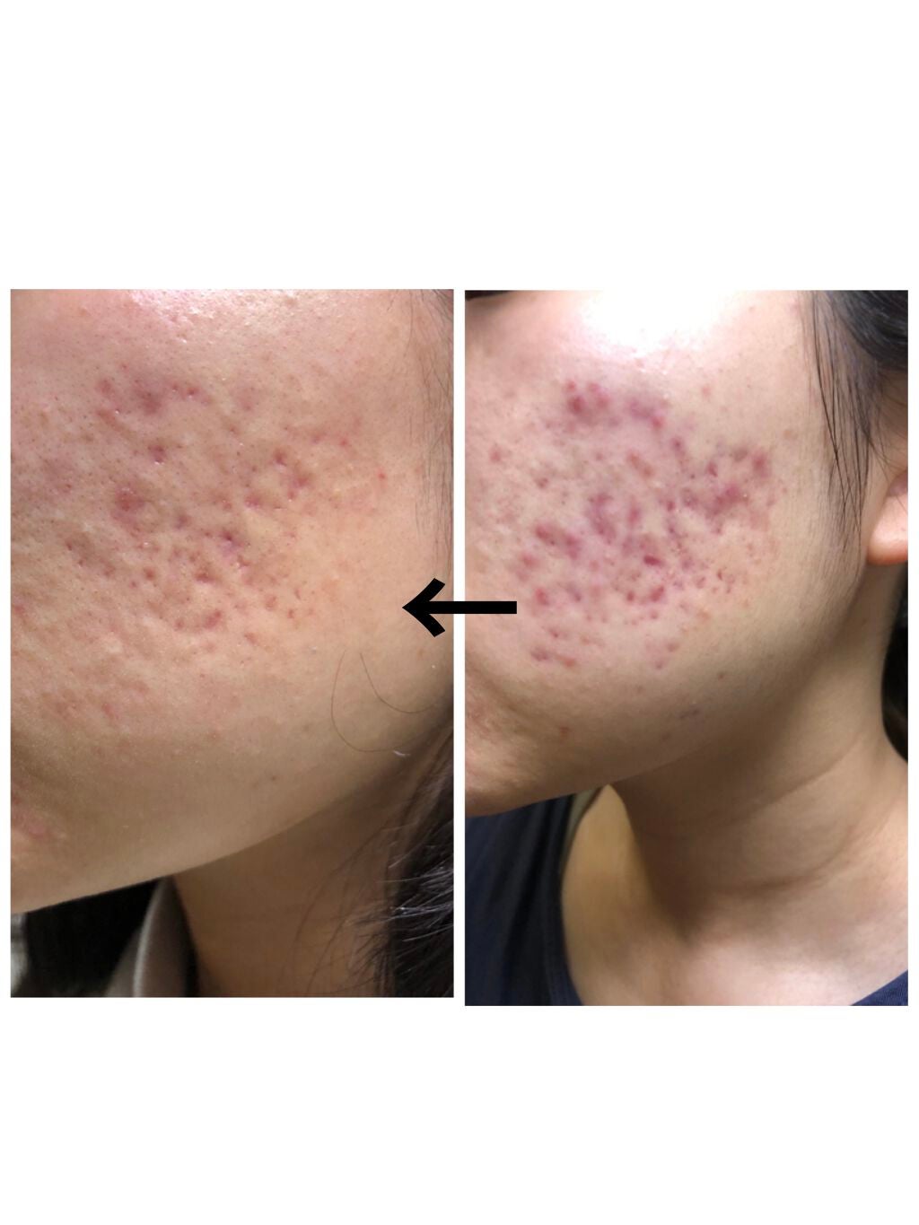 ブライトニングクレンジングEX/IGNIS/クレンジングクリームを使ったクチコミ(1枚目)