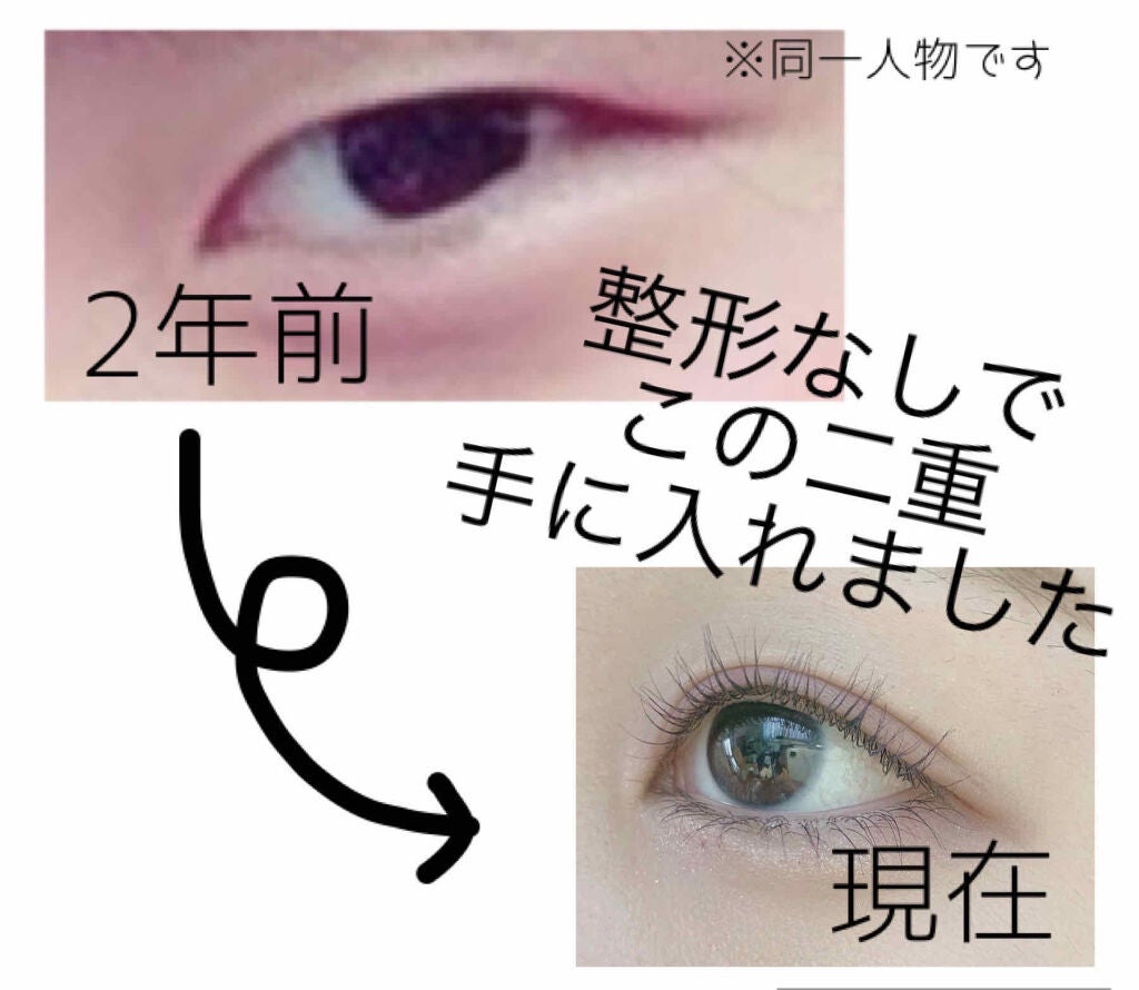 ワンダーアイリッドテープ Extra/D-UP/二重まぶた用アイテムを使ったクチコミ(1枚目)