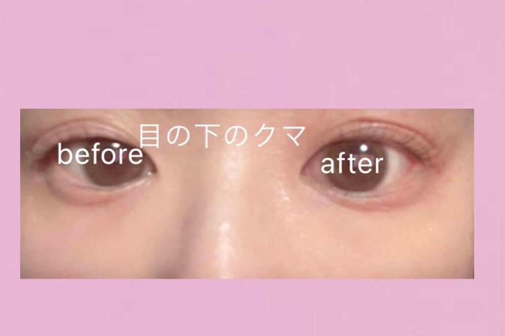 トーンパーフェクティング パレット/DECORTÉ/パレットコンシーラーを使ったクチコミ(4枚目)