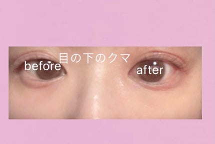 トーンパーフェクティング パレット/DECORTÉ/パレットコンシーラーを使ったクチコミ(4枚目)