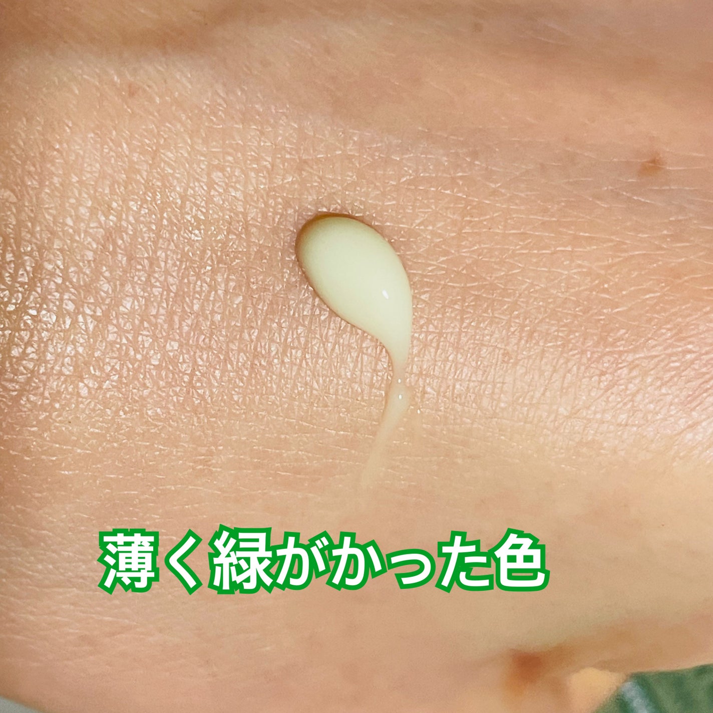 シカレチA エッセンス0.3/VT/美容液を使ったクチコミ(3枚目)