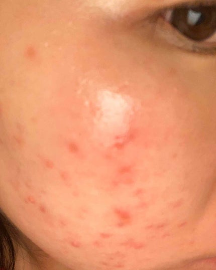 を使ったクチコミ(1枚目)