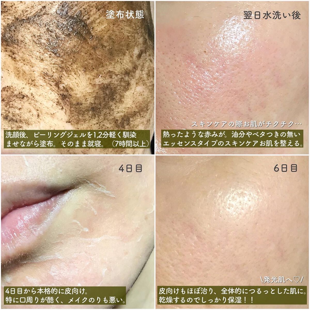 ダーマスキンピーリング/BQCELL/その他キットセットを使ったクチコミ（3枚目）