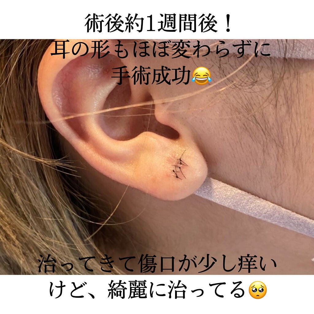 みや on LIPS 「こんばんは〜!!遅くなりましたが、あけましておめでとうございま..」(3枚目)