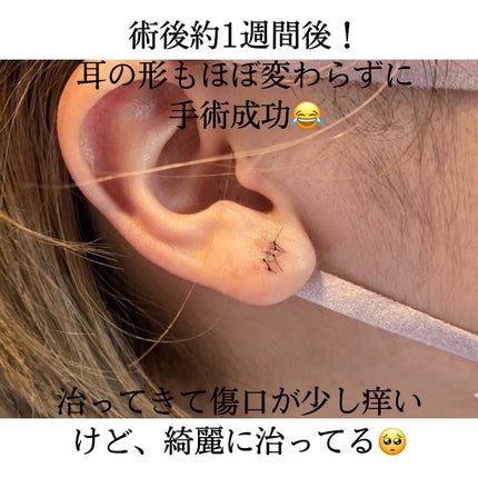 みや on LIPS 「こんばんは〜!!遅くなりましたが、あけましておめでとうございま..」(3枚目)