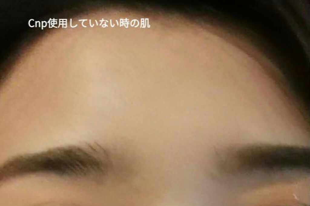 プロポリス エネルギーアンプル/CNP Laboratory/美容液を使ったクチコミ（3枚目）