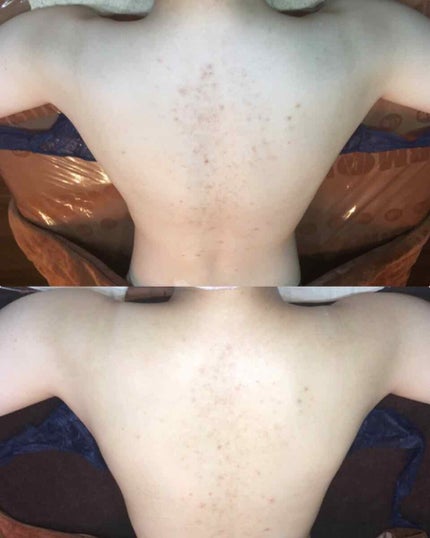 いつかの石けん/水橋保寿堂製薬/洗顔石鹸を使ったクチコミ(4枚目)