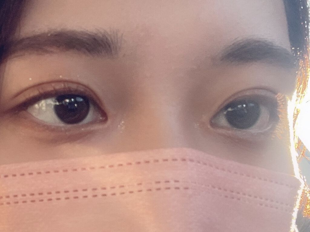 【旧】ディオールスキン フォーエヴァー スキン コレクト コンシーラー/Dior/リキッドコンシーラーを使ったクチコミ（2枚目）