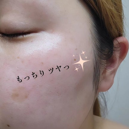 モイストゲルホワイト/Re dermalab/オールインワン化粧品を使ったクチコミ(5枚目)