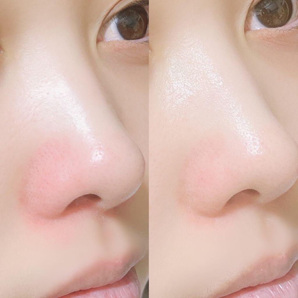 ð ðŸ ð ðŸ â on LIPS ãèµ€ã¿ã®é®éã«æåãð¥ºéäžé®éã±ã¢ã«unpaLactoCicaâ..ãïŒ4æç®ïŒ