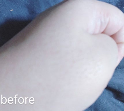 エニークッション オールデイパーフェクト/ETUDE/クッションファンデーションを使ったクチコミ(4枚目)