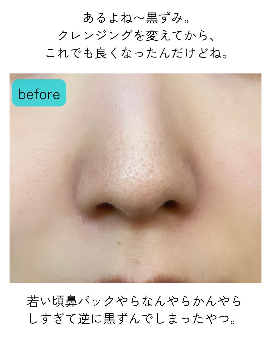 ディープクリーンマスター/ilso/その他スキンケアグッズを使ったクチコミ（3枚目）