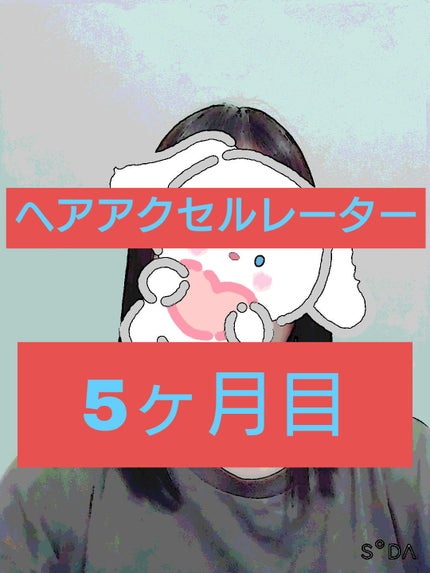 ヘアアクセルレーターEX フローラルアップルの香り/加美乃素本舗/頭皮ローションを使ったクチコミ(1枚目)