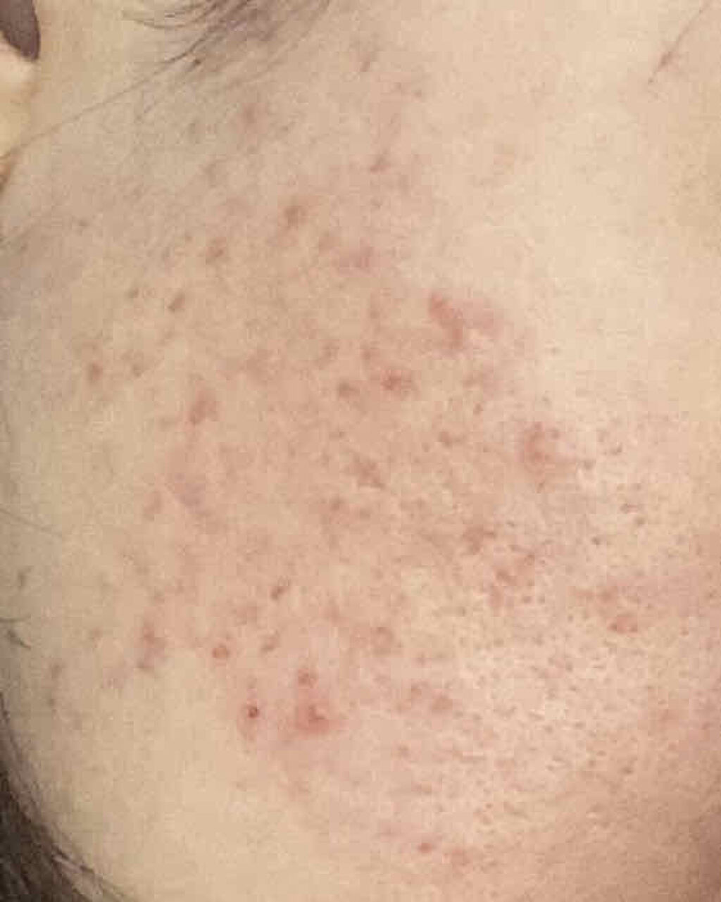 DHC マルチビタミン/DHC/美容サプリメントを使ったクチコミ（2枚目）