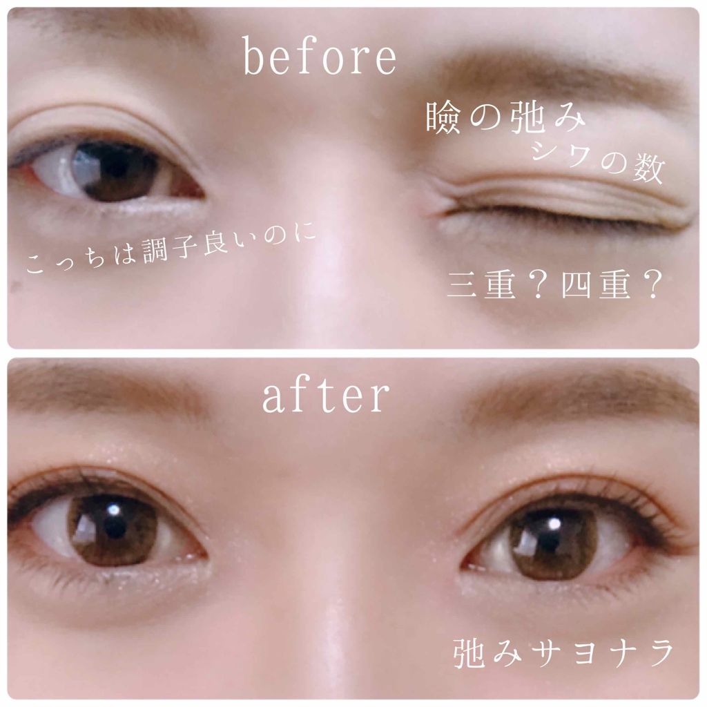 【旧品】オリシキ アイリッドスキンフィルム/D-UP/二重まぶた用アイテムを使ったクチコミ(2枚目)