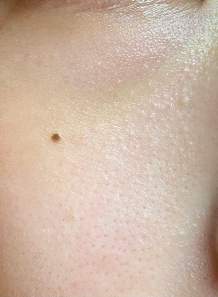 みったんちゃん on LIPS 「【助けて】毛穴?、剃れないレベルの細かな産毛(毛穴汚れに見える..」(5枚目)