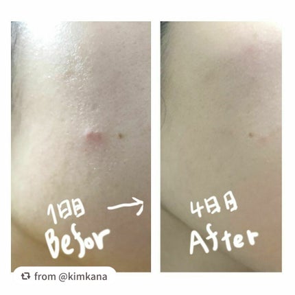 オーガニアンス ウォータリー エッセンス/primera/化粧水を使ったクチコミ(4枚目)