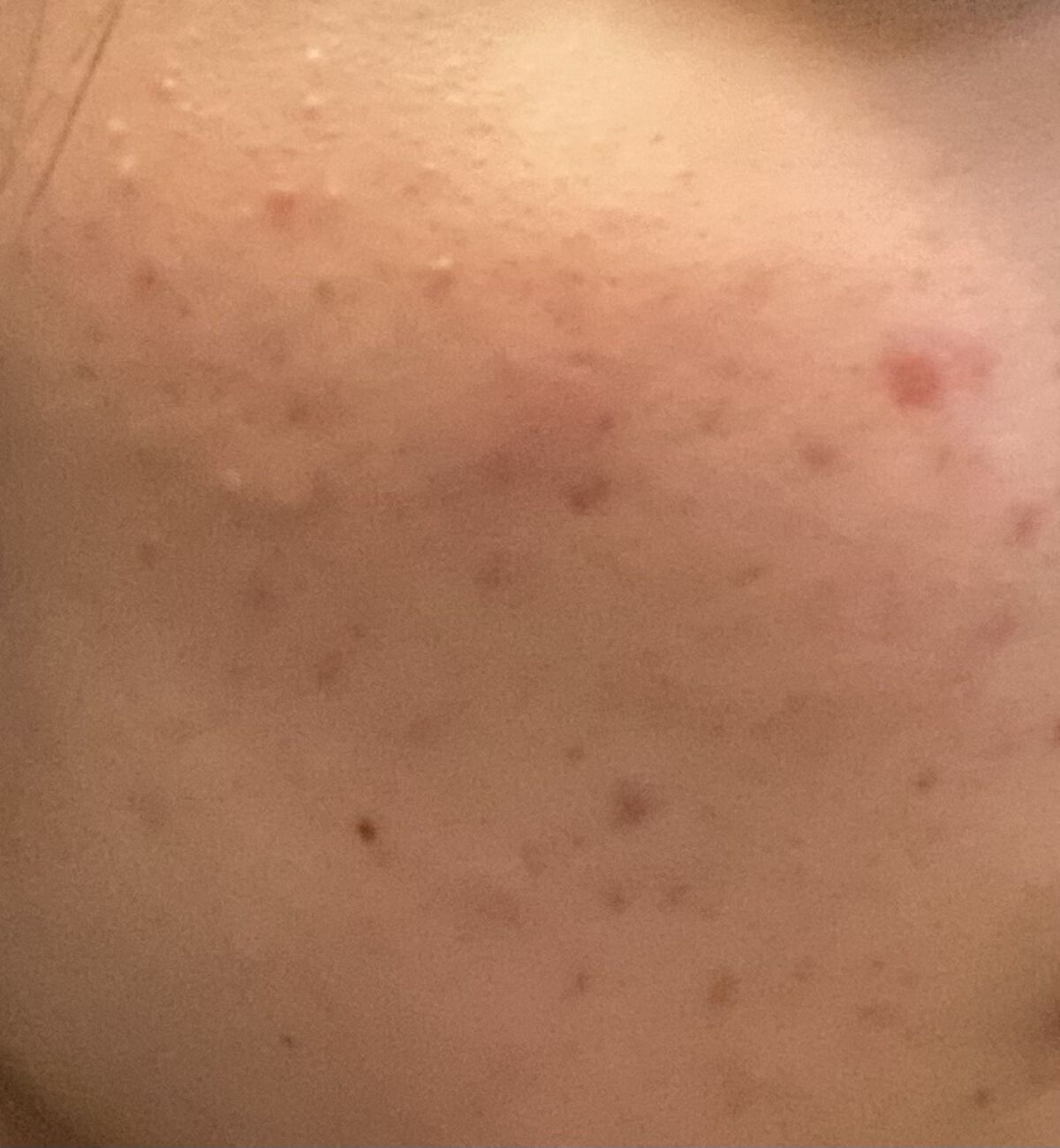 薬用ふわふわな泡洗顔/メンソレータム アクネス/泡洗顔を使ったクチコミ（2枚目）