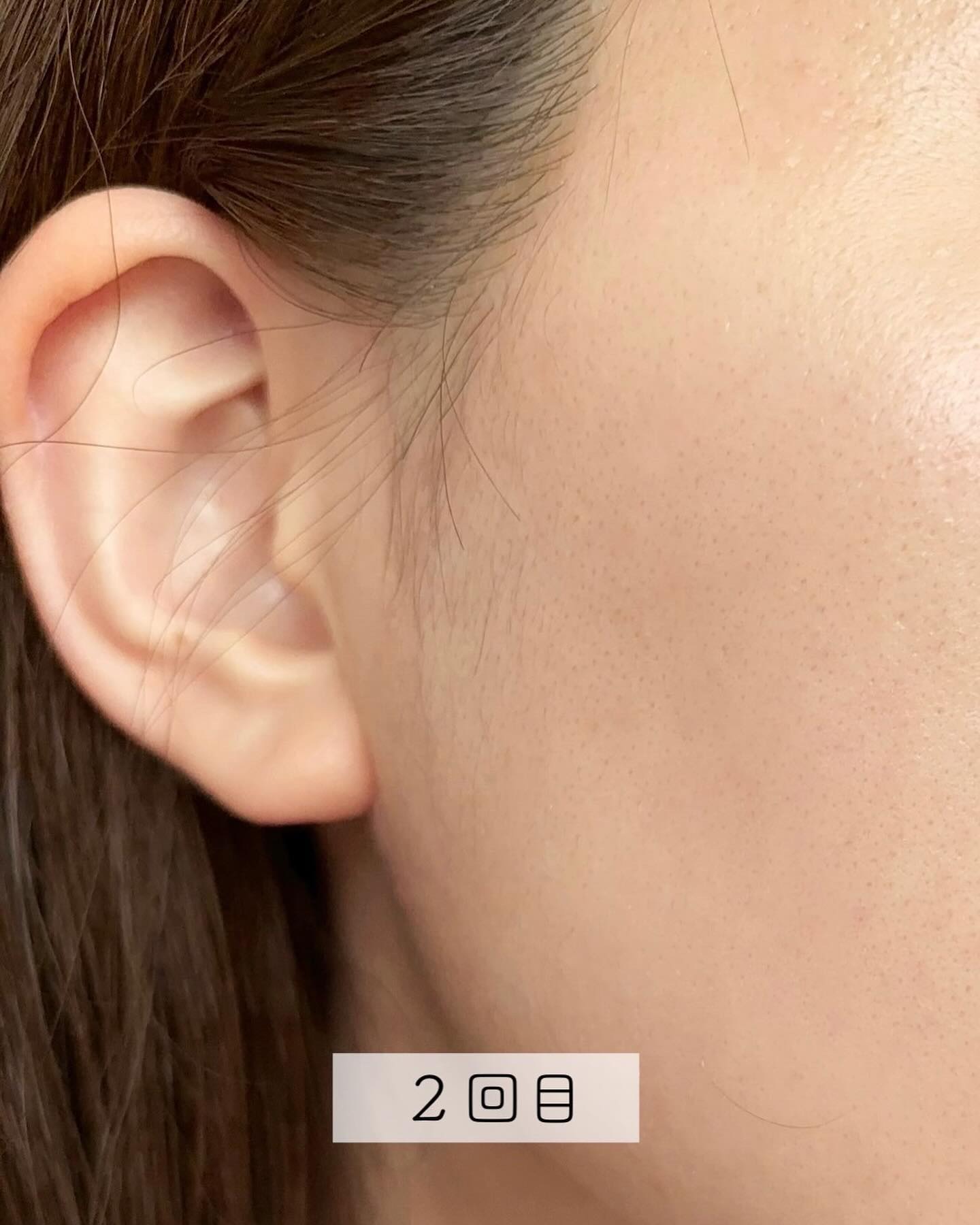 MYTREX MiRAYのクチコミ「⁡
⁡
⁡
⁡
⁡
前回紹介した MYTREX MiRAY ✨
しばらく使ってみたからレポして.....」（3枚目）