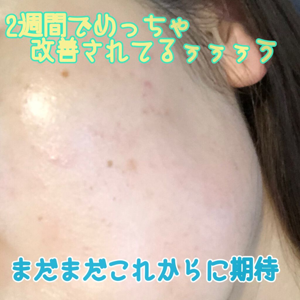 クリーム UFC/Kiehl's/フェイスクリームを使ったクチコミ(3枚目)