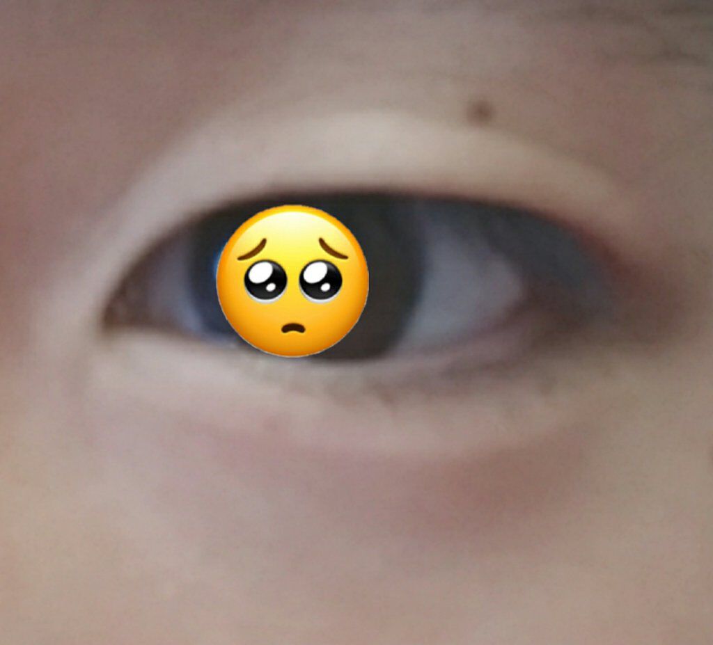 オリシキ アイリッドスキンフィルム /D-UP/二重まぶた用アイテムを使ったクチコミ(3枚目)