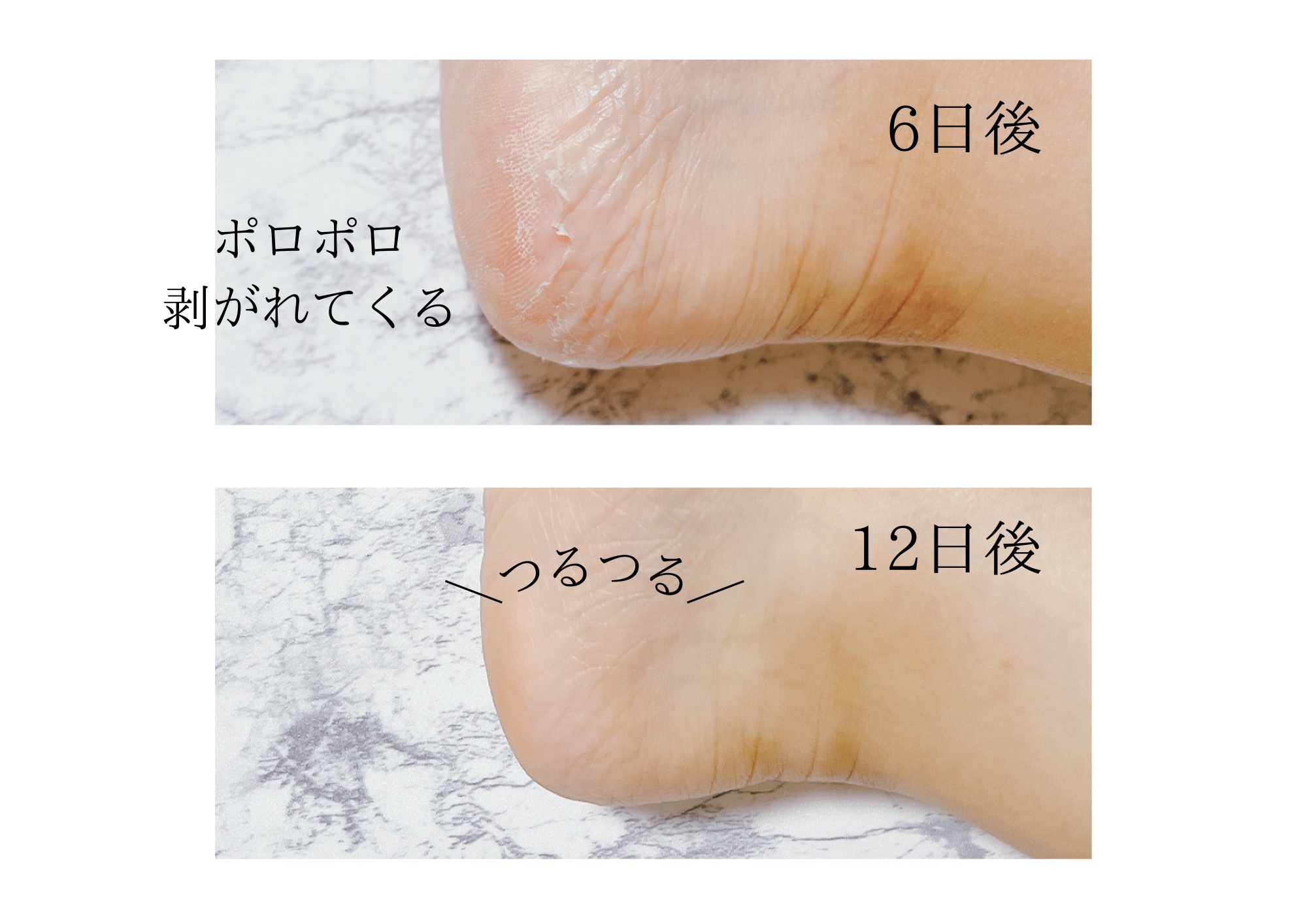 かかとピーリングマスク/ドクター・ショール/レッグ・フットケアを使ったクチコミ（3枚目）