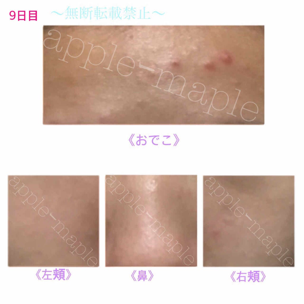 ロゼット 洗顔パスタ 荒性肌/ロゼット/洗顔フォームを使ったクチコミ(3枚目)